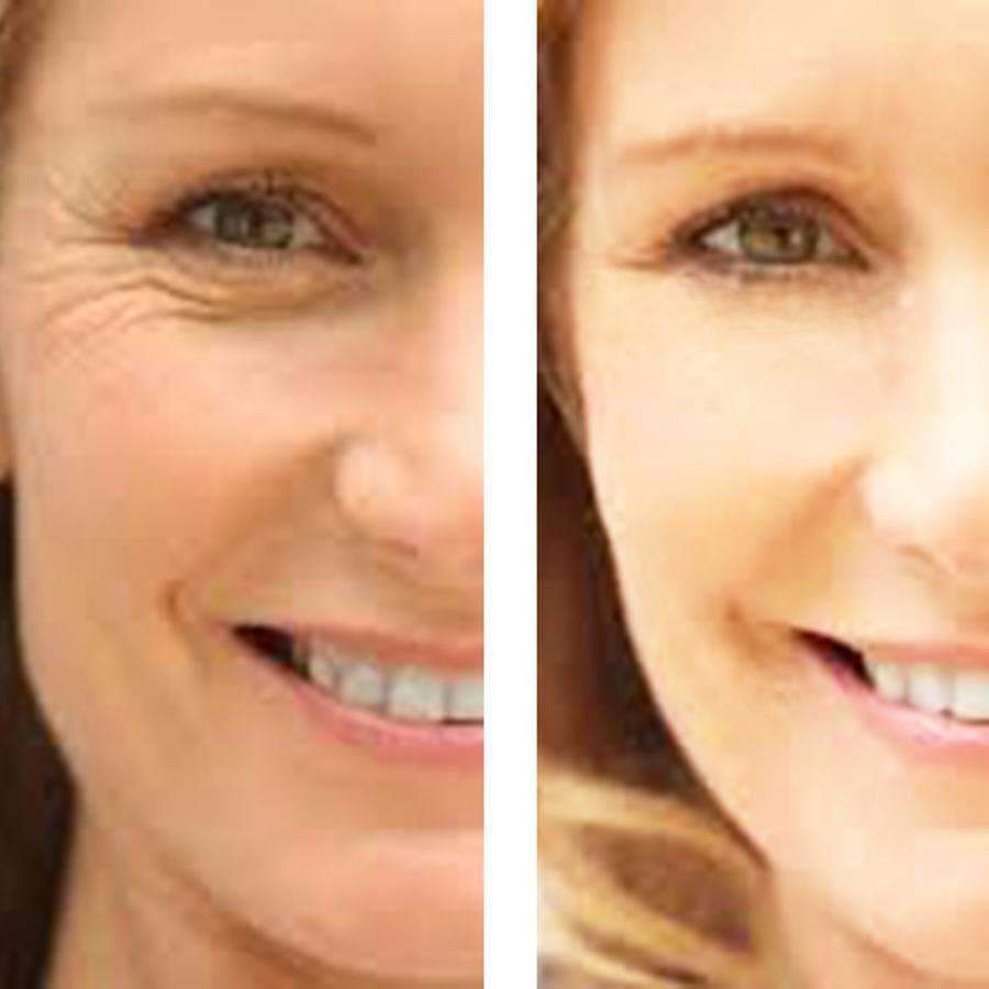 LE'VEA Age Defense: Eye Wrinkle Cream + Vitamin C Serum